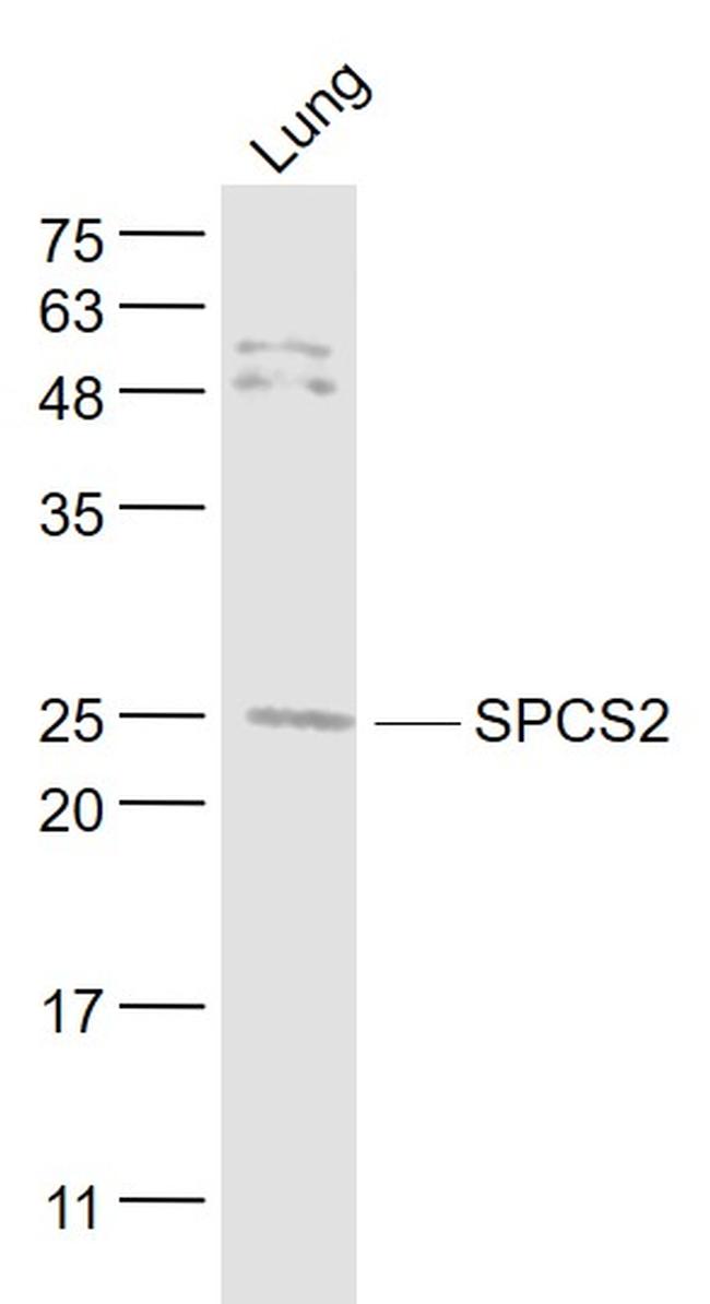 SPCS2 Antibody in Western Blot (WB)