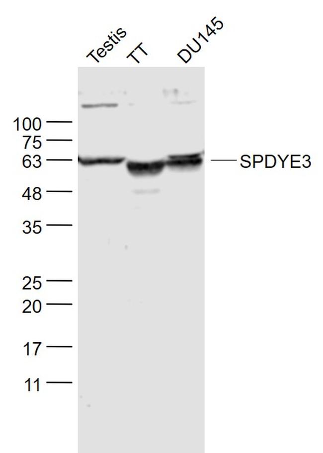 SPDYE3 Antibody in Western Blot (WB)
