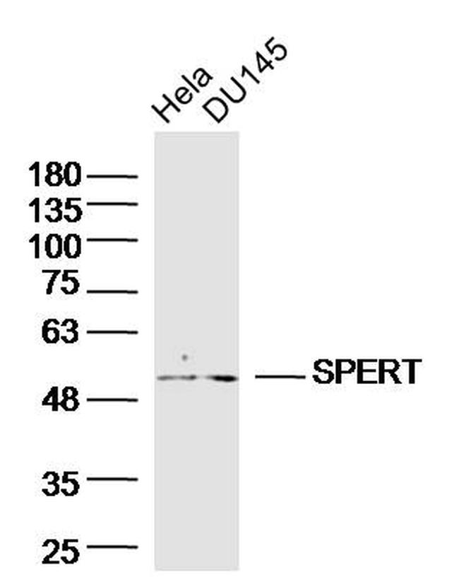SPERT Antibody in Western Blot (WB)