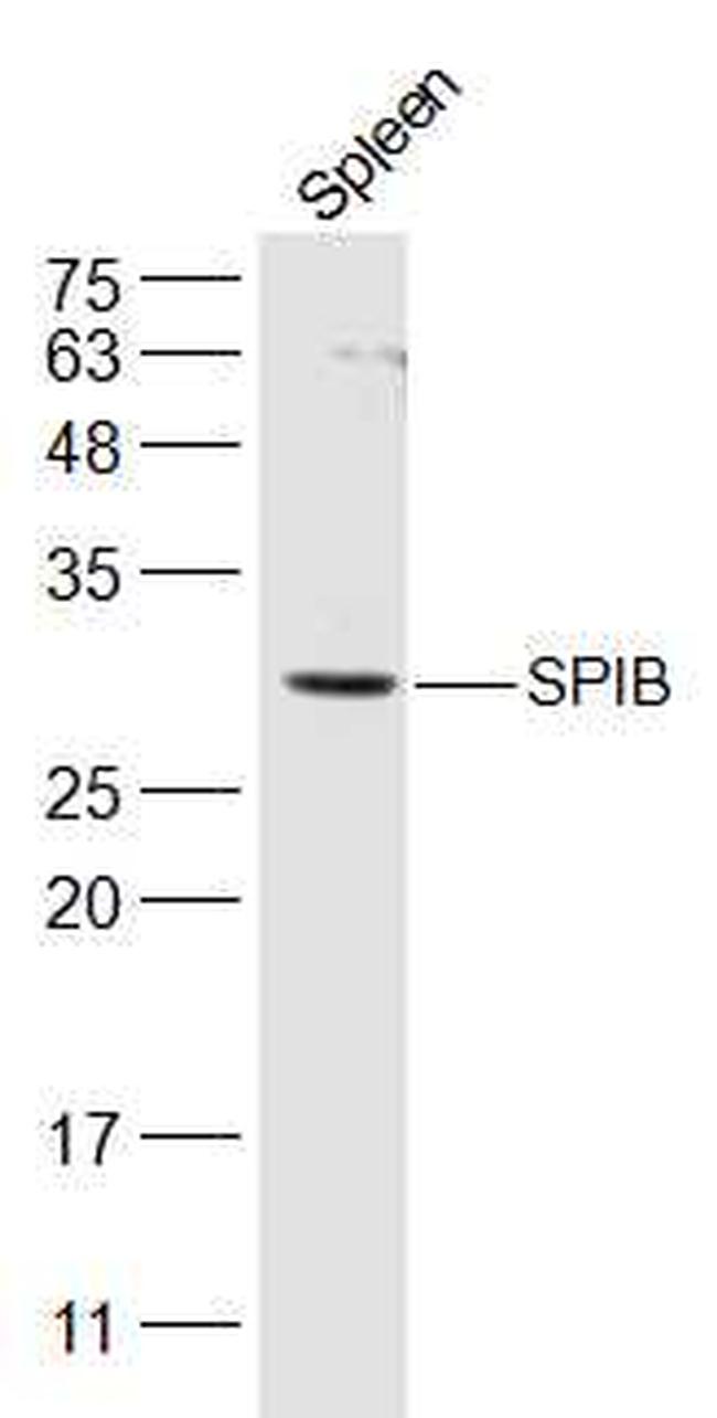 SPIB Polyclonal Antibody (BS-17663R)
