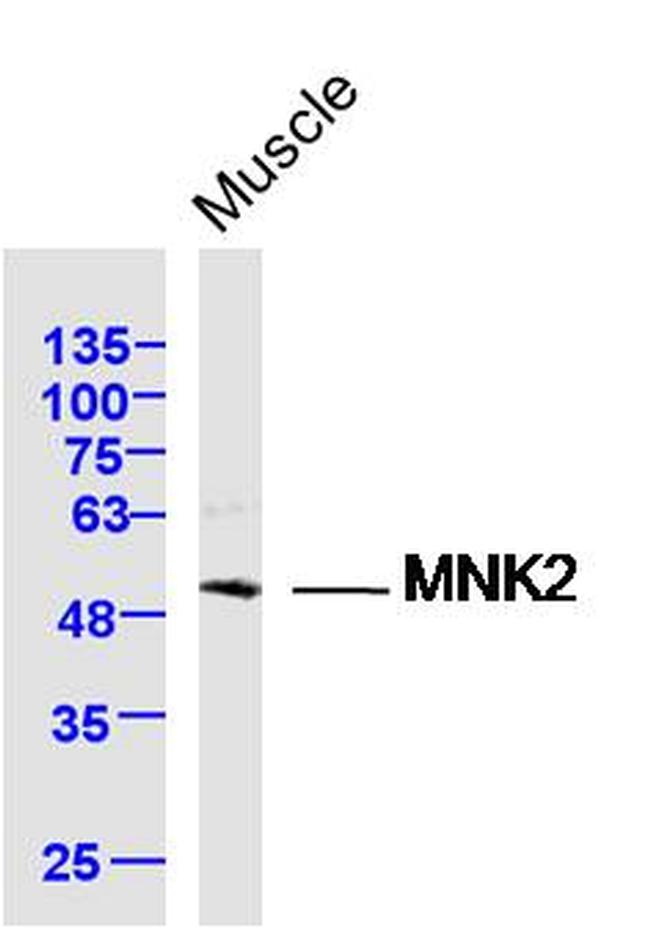 MNK2 Antibody in Western Blot (WB)