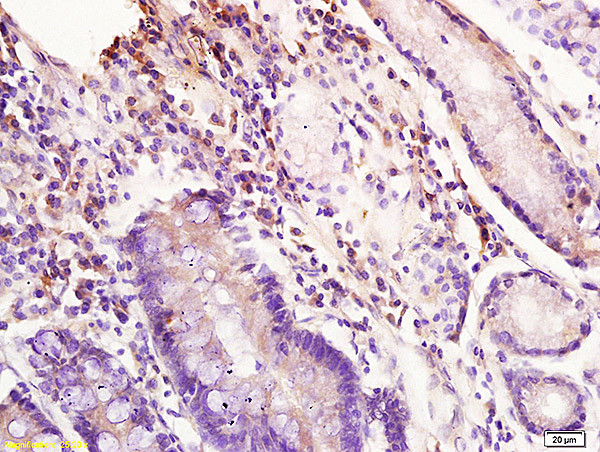 Inhibin beta A/Activin A Antibody in Immunohistochemistry (Paraffin) (IHC (P))