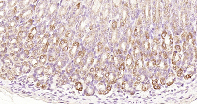 Gastrin receptor/GASR/CCKBR Antibody in Immunohistochemistry (Paraffin) (IHC (P))