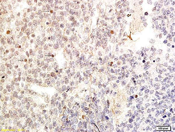 GATA4 Antibody in Immunohistochemistry (Paraffin) (IHC (P))
