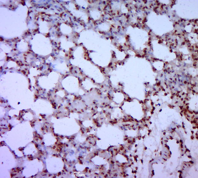 GATA5 Antibody in Immunohistochemistry (Paraffin) (IHC (P))