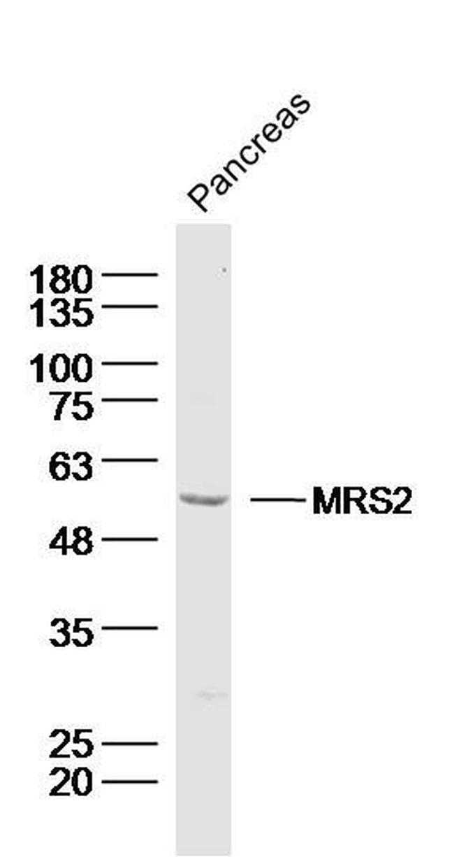 MRS2 Antibody in Western Blot (WB)