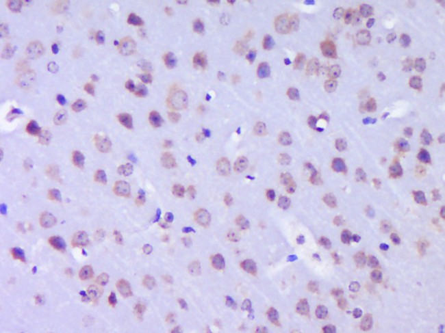 MTHFSD Antibody in Immunohistochemistry (Paraffin) (IHC (P))