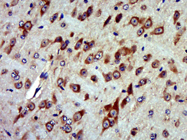 MTRF1 Antibody in Immunohistochemistry (Paraffin) (IHC (P))