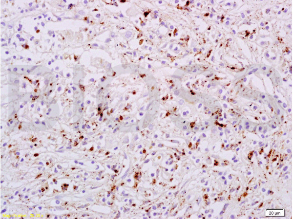 Phospho-STAT6 (Tyr641) Antibody in Immunohistochemistry (Paraffin) (IHC (P))