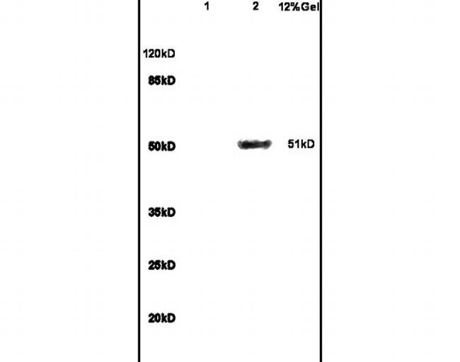 GCK/Glucokinase Antibody in Western Blot (WB)