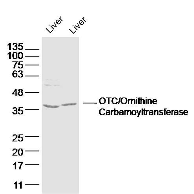 OTC Antibody in Western Blot (WB)