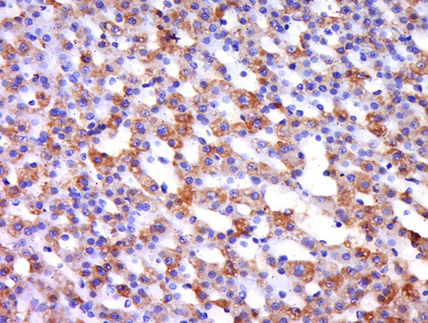 Integrin alpha L/CD11a Antibody in Immunohistochemistry (Paraffin) (IHC (P))