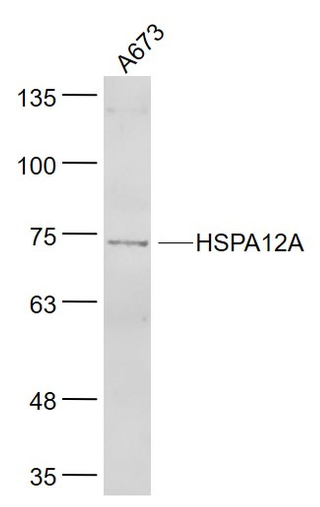 HSPA12A Antibody in Western Blot (WB)