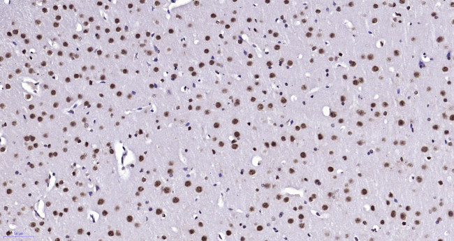 Notch3/4 Antibody in Immunohistochemistry (Paraffin) (IHC (P))