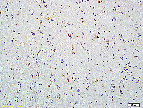 HDAC2/HD2 Antibody in Immunohistochemistry (Paraffin) (IHC (P))