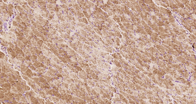 Integrin alpha 7/ITGA7 Antibody in Immunohistochemistry (Paraffin) (IHC (P))