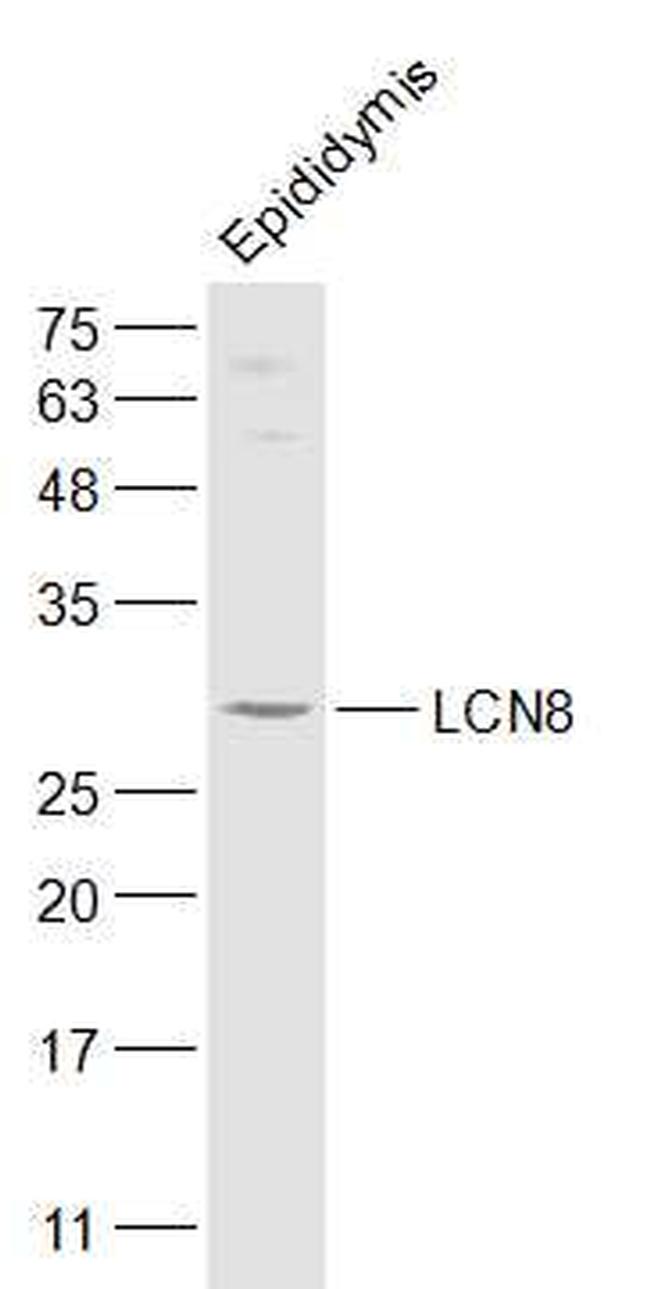 LCN8 Antibody in Western Blot (WB)