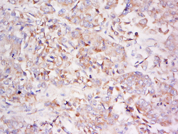 LDLRAD3 Antibody in Immunohistochemistry (Paraffin) (IHC (P))