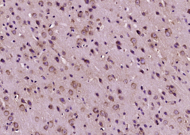 Calcitonin Antibody in Immunohistochemistry (Paraffin) (IHC (P))
