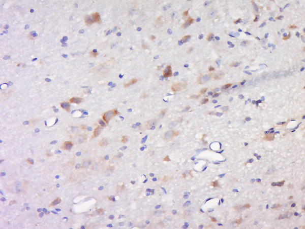Inhibin Beta C Antibody in Immunohistochemistry (Paraffin) (IHC (P))