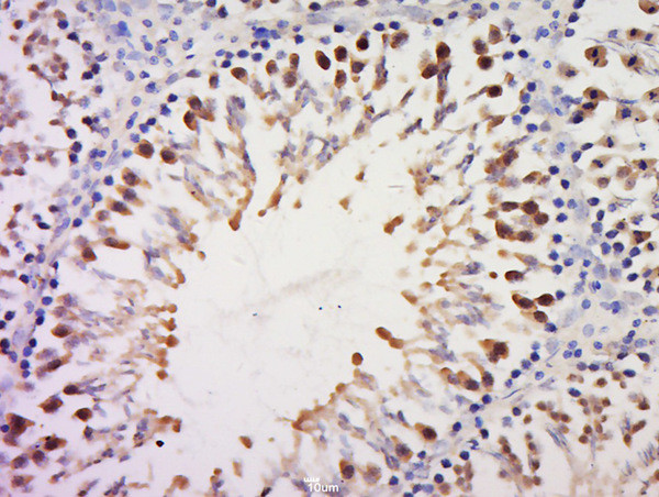 RPS20 Antibody in Immunohistochemistry (Paraffin) (IHC (P))