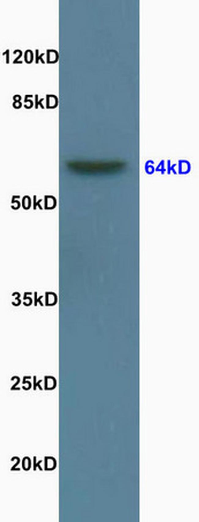 Lamin B1 Antibody in Western Blot (WB)