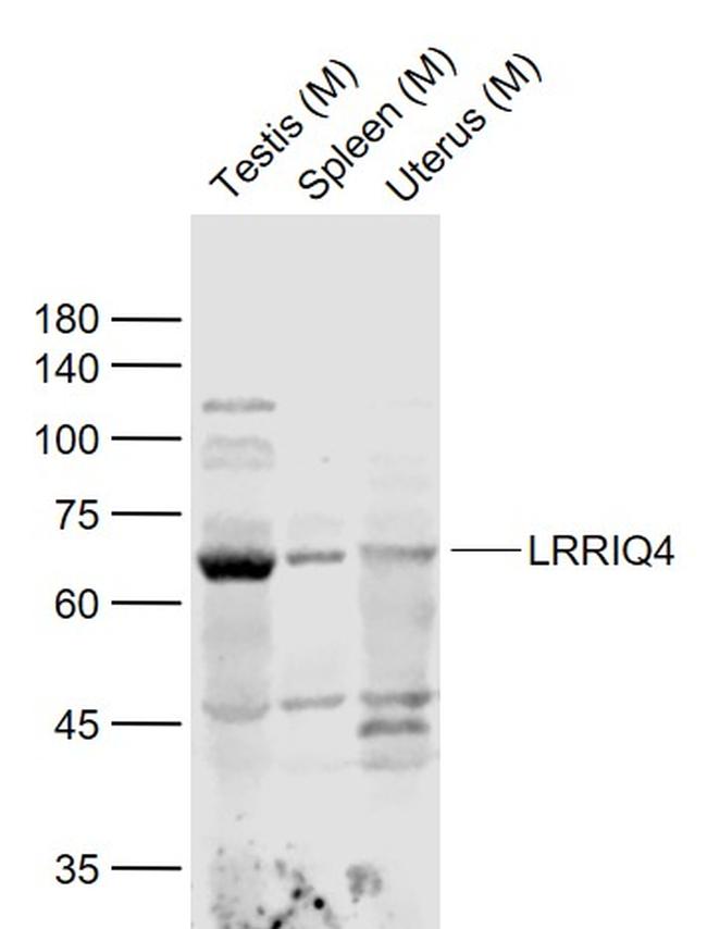 LRRIQ4 Antibody in Western Blot (WB)