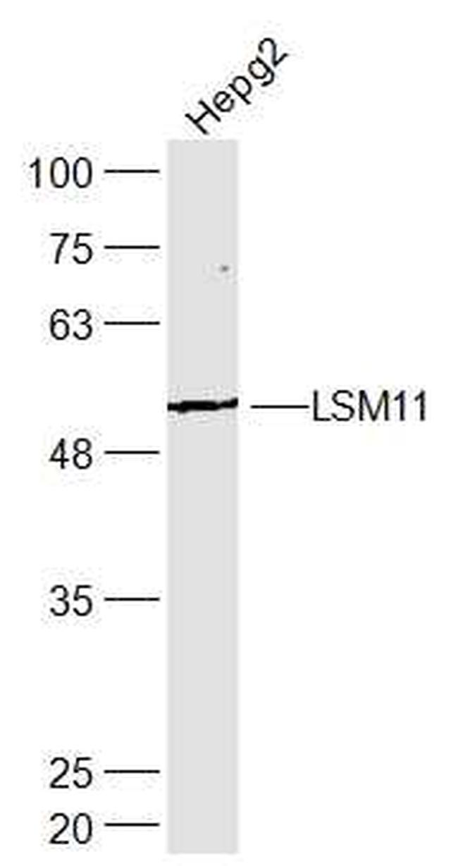 LSM11 Antibody in Western Blot (WB)