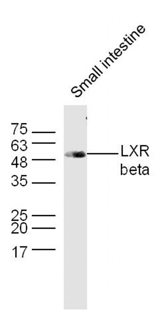 LXR beta Antibody in Western Blot (WB)