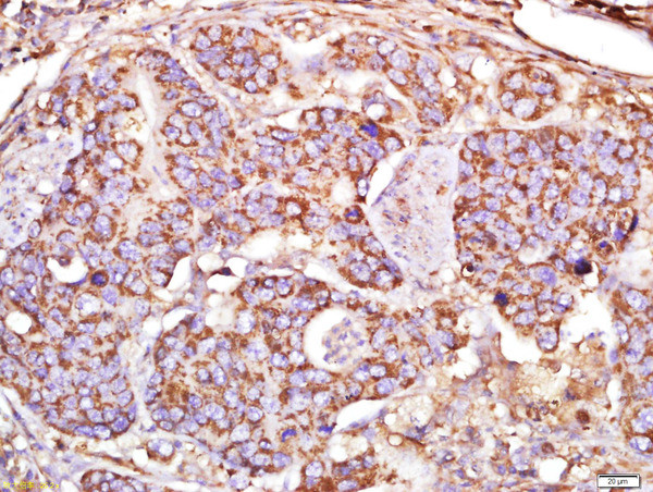 MAP1A Antibody in Immunohistochemistry (Paraffin) (IHC (P))