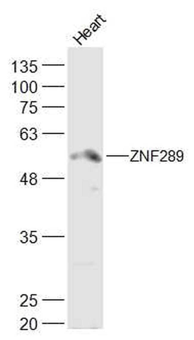 ZNF289/ARFGAP2 Antibody in Western Blot (WB)