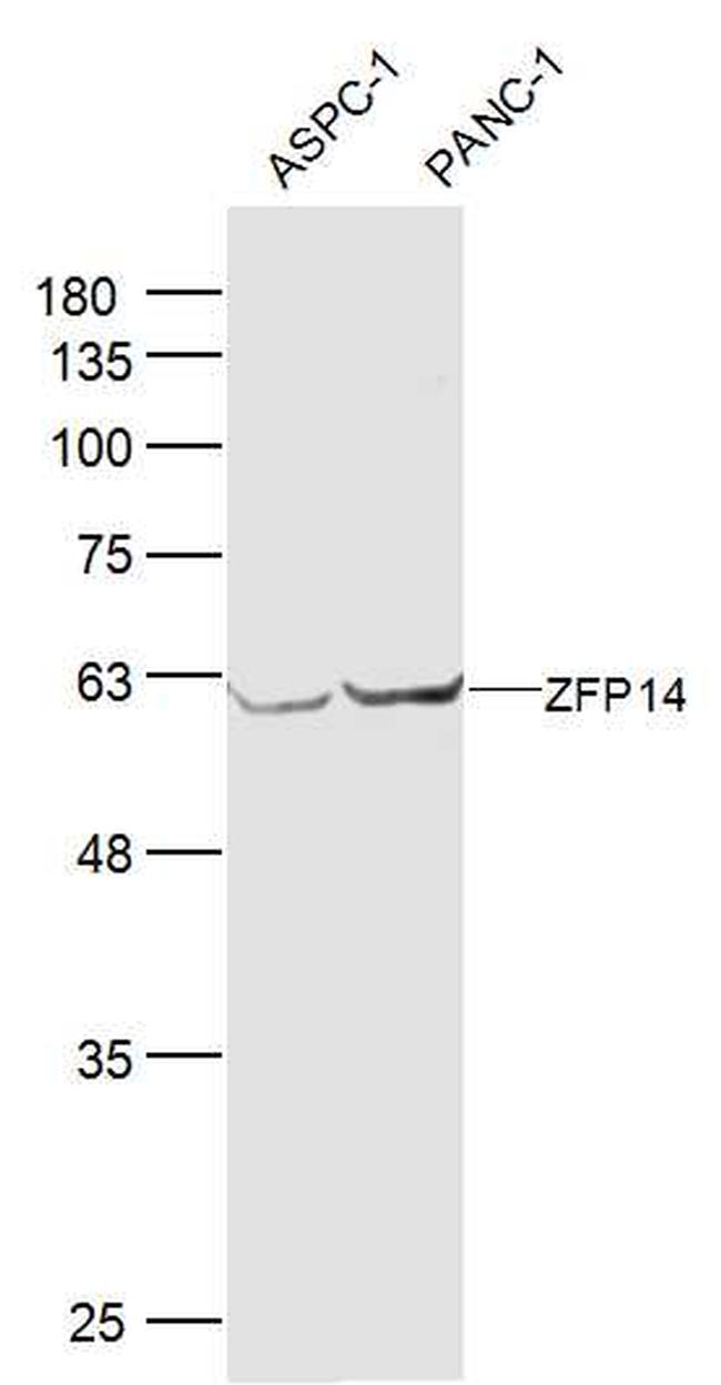 ZFP14 Antibody in Western Blot (WB)