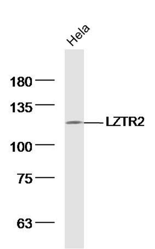LZTR2 Antibody in Western Blot (WB)