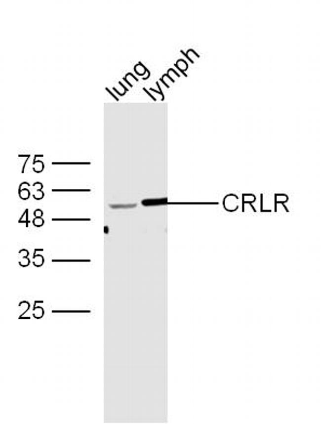 CRLR/CGRPR1 Antibody in Western Blot (WB)