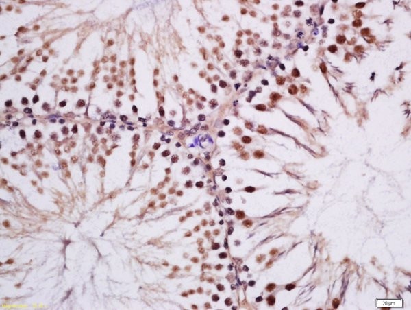 Phospho-MAK (Tyr159) Antibody in Immunohistochemistry (Paraffin) (IHC (P))