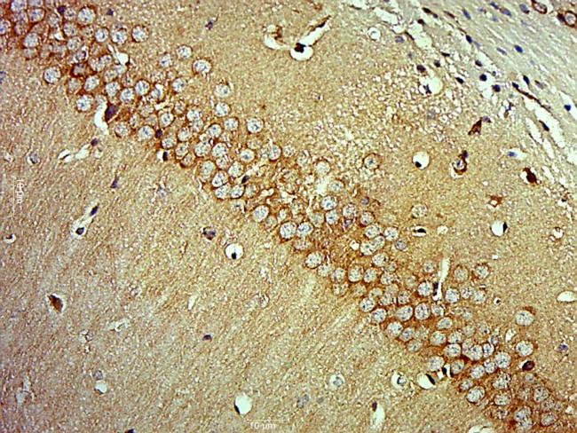 MAP3K13 Antibody in Immunohistochemistry (Paraffin) (IHC (P))