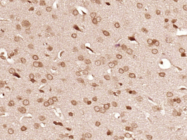 PRCP Antibody in Immunohistochemistry (Paraffin) (IHC (P))