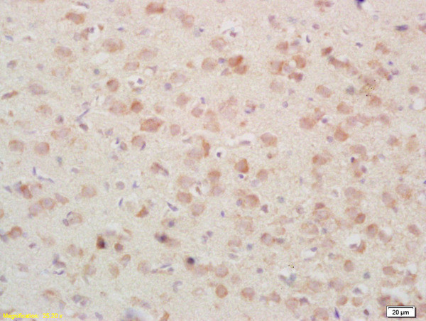 PSAP/PAP Antibody in Immunohistochemistry (Paraffin) (IHC (P))