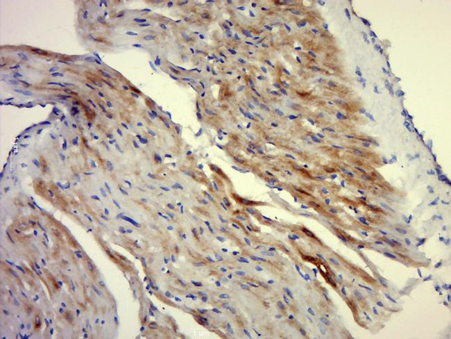 M-RAS/Mras Antibody in Western Blot (WB)