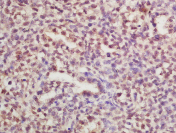 RPLP0 Antibody in Immunohistochemistry (Paraffin) (IHC (P))