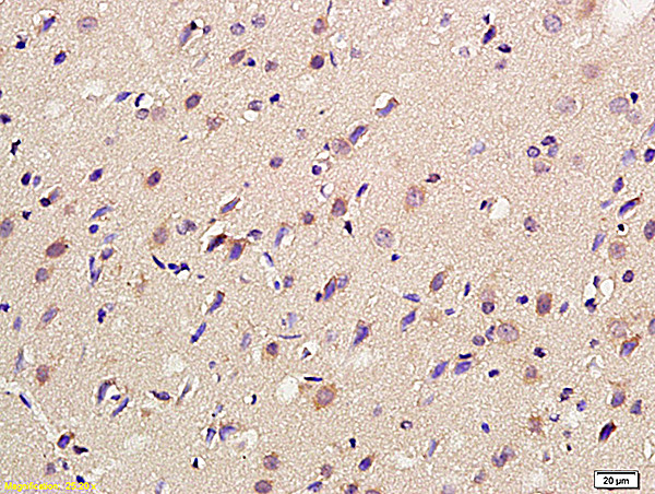 Metabotropic Glutamate Receptor 4/6 Antibody in Immunohistochemistry (Paraffin) (IHC (P))