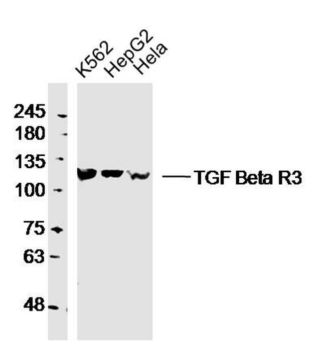TGF Beta R3 Polyclonal Antibody (BS-1910R)