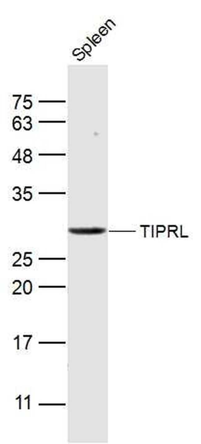 TIPRL Antibody in Western Blot (WB)