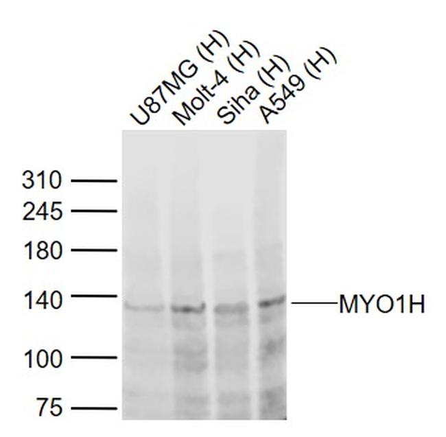 MYO1H Antibody in Western Blot (WB)