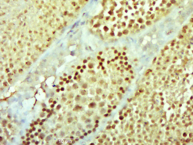 NEK11 Antibody in Immunohistochemistry (Paraffin) (IHC (P))