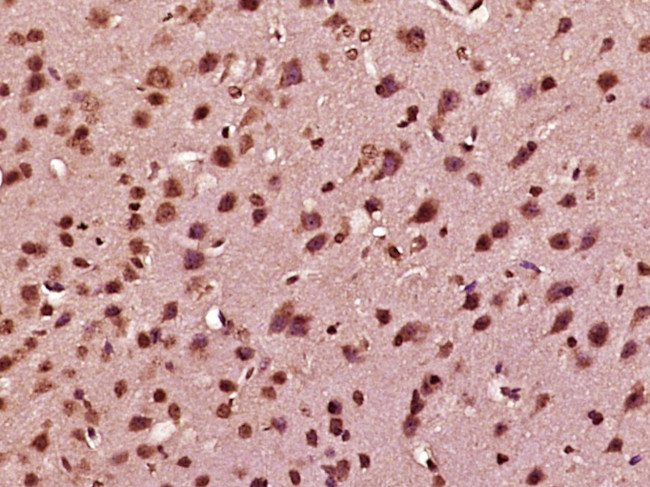 Nesprin 3 Antibody in Immunohistochemistry (Paraffin) (IHC (P))