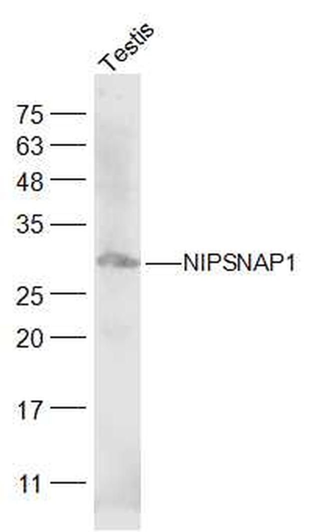 NIPSNAP1 Antibody in Western Blot (WB)