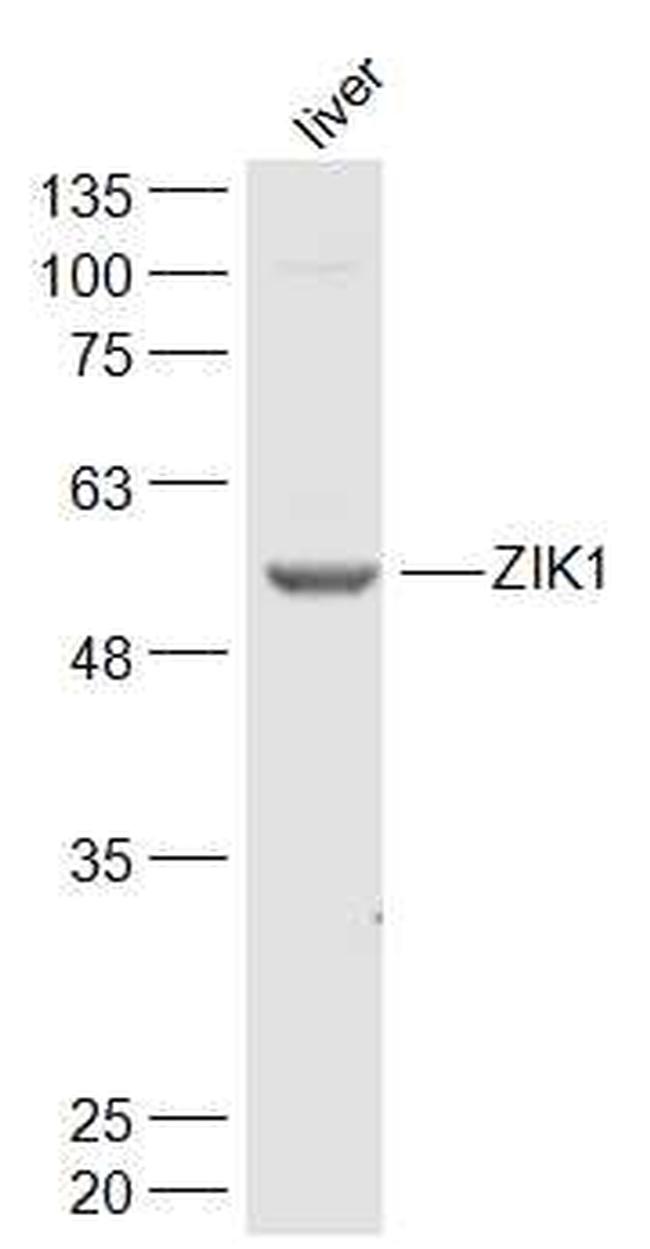 ZIK1 Antibody in Western Blot (WB)