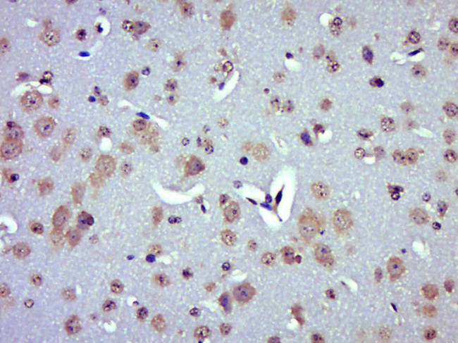 UCP-2 Antibody in Immunohistochemistry (Paraffin) (IHC (P))
