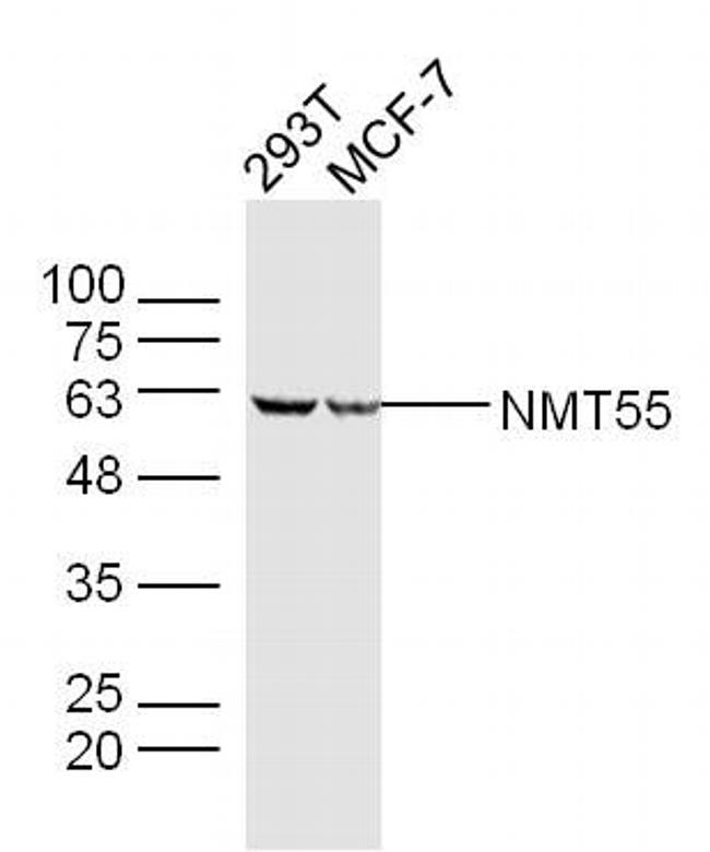 NMT55 Antibody in Western Blot (WB)